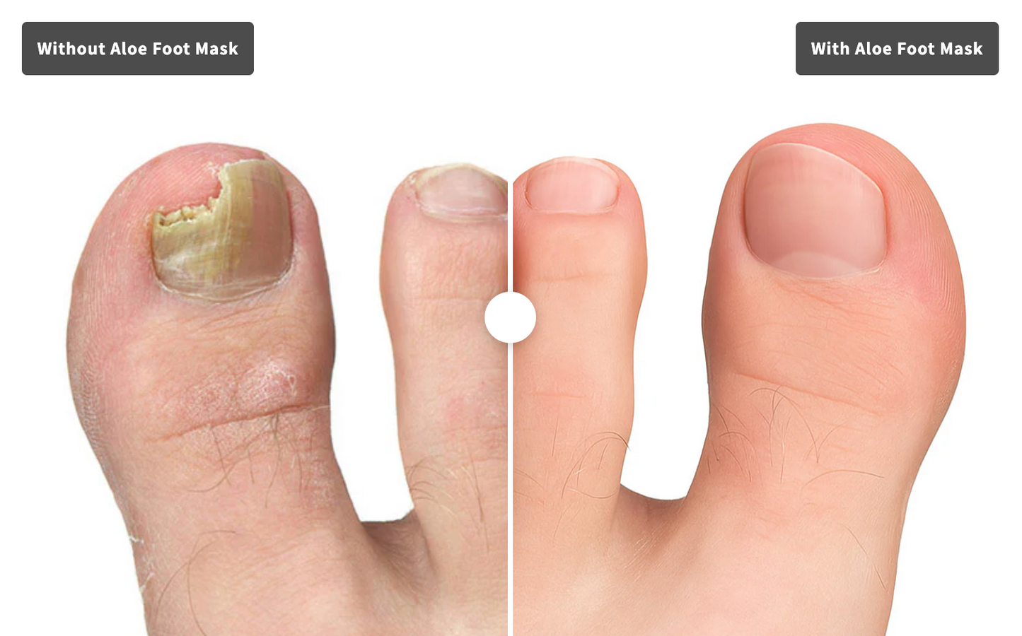 Renewedline Aloe Foot Mask