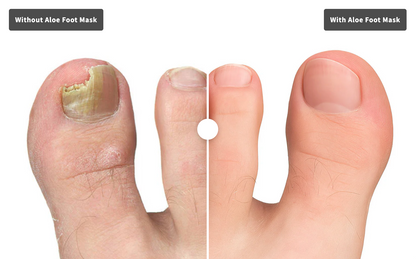 Renewedline Aloe Foot Mask
